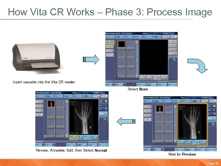 How Vita CR Works – Phase 3: Process Image Insert cassette into the Vita