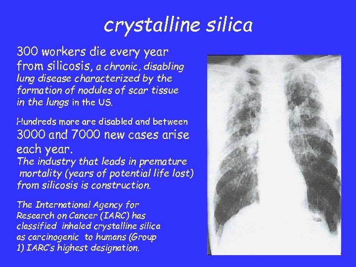crystalline silica 300 workers die every year from silicosis, a chronic, disabling lung disease