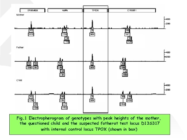 Fig. 1 Electropherogram of genotypes with peak heights of the mother, the questioned child