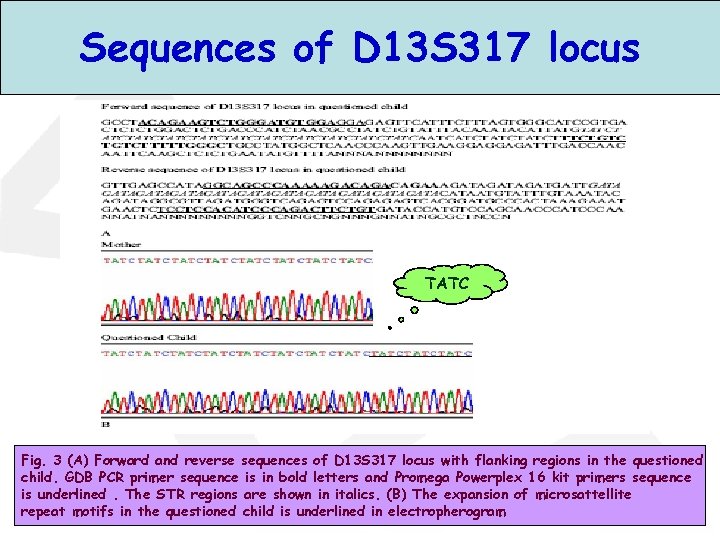 Sequences of D 13 S 317 locus TATC Fig. 3 (A) Forward and reverse