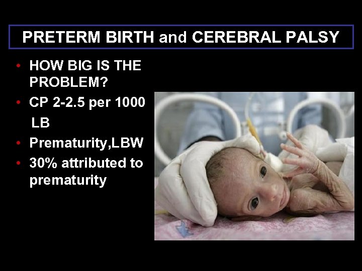 PRETERM BIRTH and CEREBRAL PALSY • HOW BIG IS THE PROBLEM? • CP 2