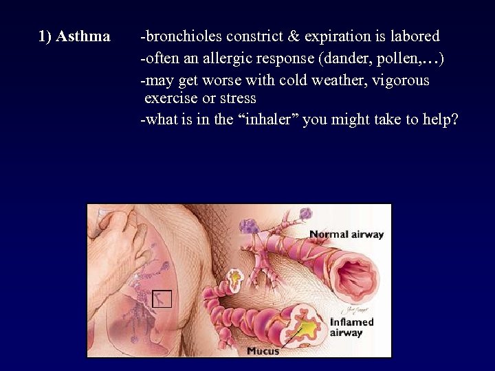 1) Asthma -bronchioles constrict & expiration is labored -often an allergic response (dander, pollen,