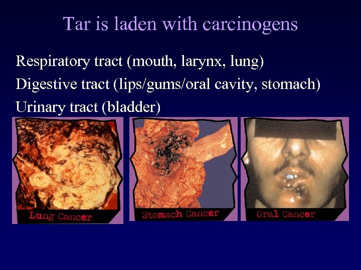 Tar is laden with carcinogens Respiratory tract (mouth, larynx, lung) Digestive tract (lips/gums/oral cavity,