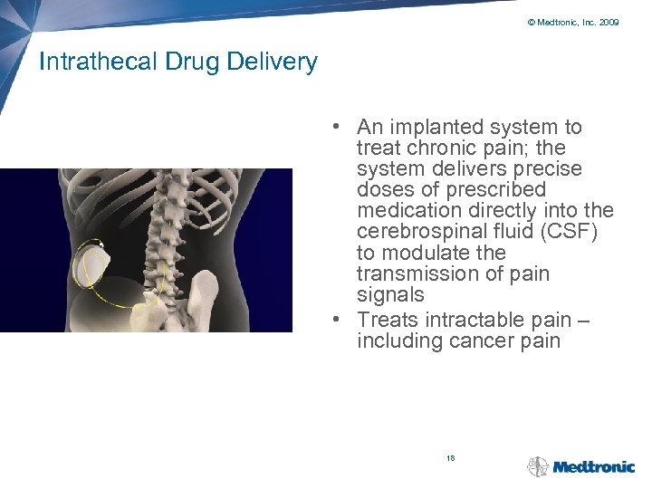 © Medtronic, Inc. 2009 Intrathecal Drug Delivery • An implanted system to treat chronic