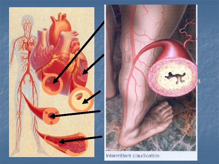 E. Никотин повреждает стенки артерий C. Никотин заставляет сердечную мышцу перенапрягаться B. Никотин ведет