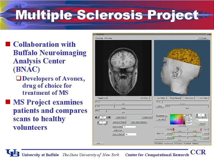 Multiple Sclerosis Project n Collaboration with Buffalo Neuroimaging Analysis Center (BNAC) q Developers of