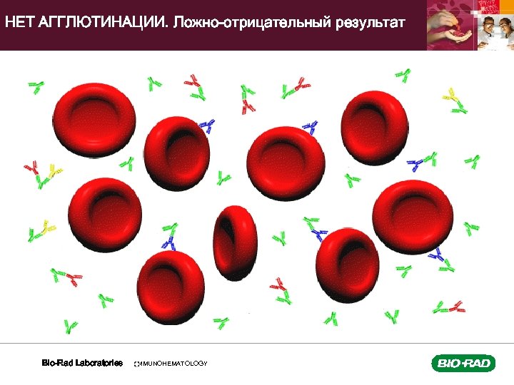 НЕТ АГГЛЮТИНАЦИИ. Ложно-отрицательный результат Bio-Rad Laboratories IMMUNOHEMATOLOGY 