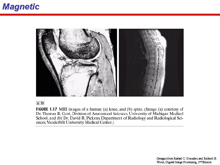 Magnetic (Images from Rafael C. Gonzalez and Richard E. Wood, Digital Image Processing, 2