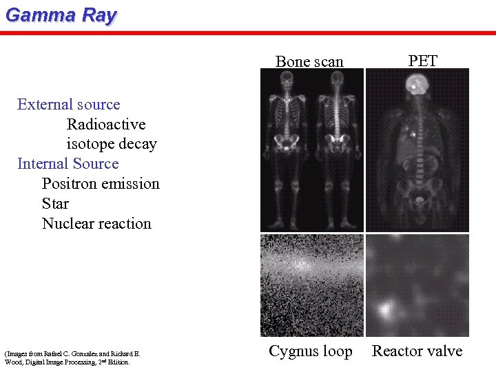 Gamma Ray Bone scan PET External source Radioactive isotope decay Internal Source Positron emission
