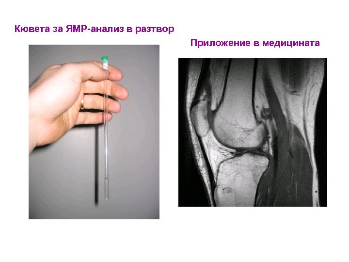 Кювета за ЯМР-анализ в разтвор Приложение в медицината 