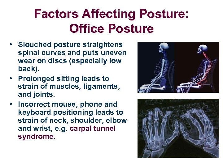 Factors Affecting Posture: Office Posture • Slouched posture straightens spinal curves and puts uneven