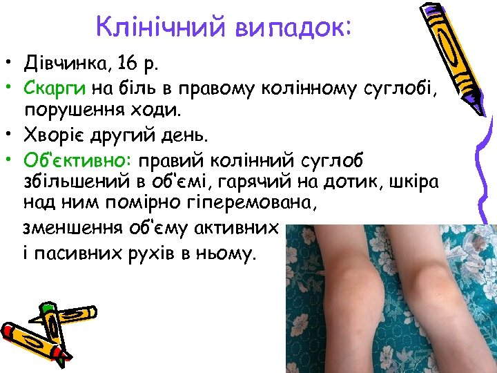 Клінічний випадок: • Дівчинка, 16 р. • Скарги на біль в правому колінному суглобі,