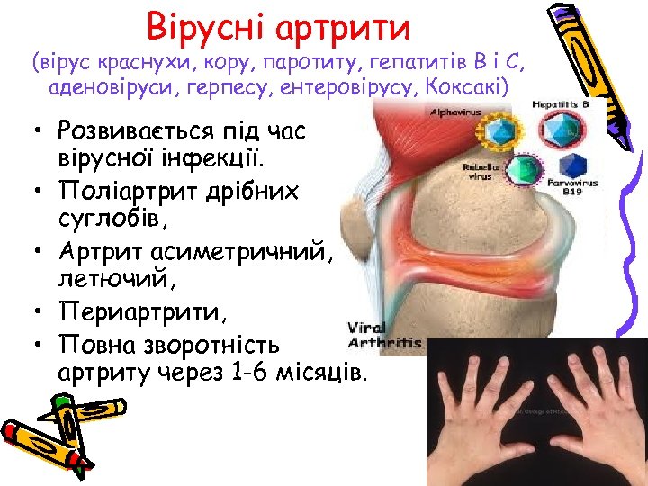 Вірусні артрити (вірус краснухи, кору, паротиту, гепатитів В і С, аденовіруси, герпесу, ентеровірусу, Коксакі)