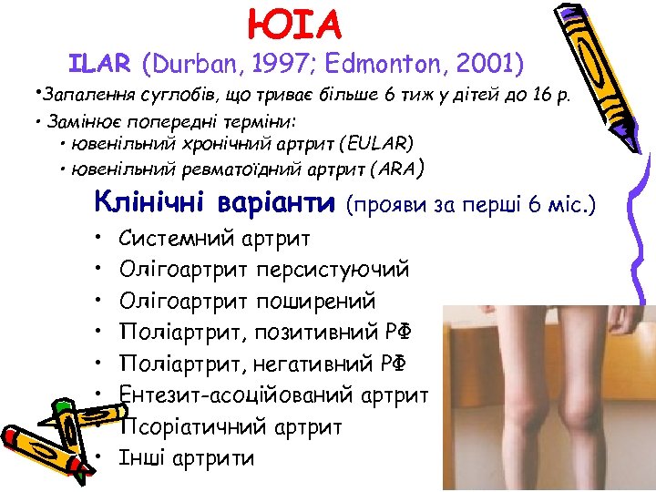 ЮІА ILAR (Durban, 1997; Edmonton, 2001) • Запалення суглобів, що триває більше 6 тиж