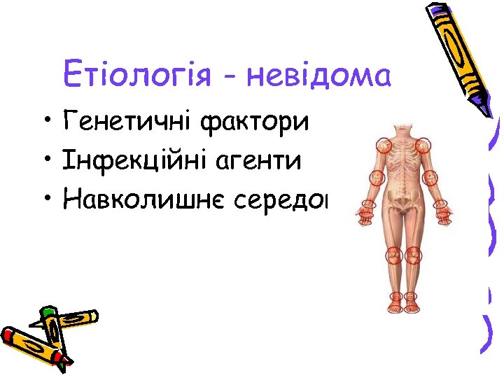 Етіологія - невідома • Генетичні фактори • Інфекційні агенти • Навколишнє середовище 