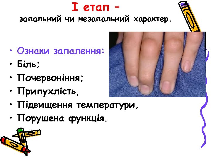 І етап – запальний чи незапальний характер. • • • Ознаки запалення: Біль; Почервоніння;