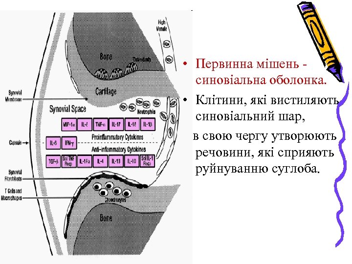  • Первинна мішень синовіальна оболонка. • Клітини, які вистиляють синовіальний шар, в свою