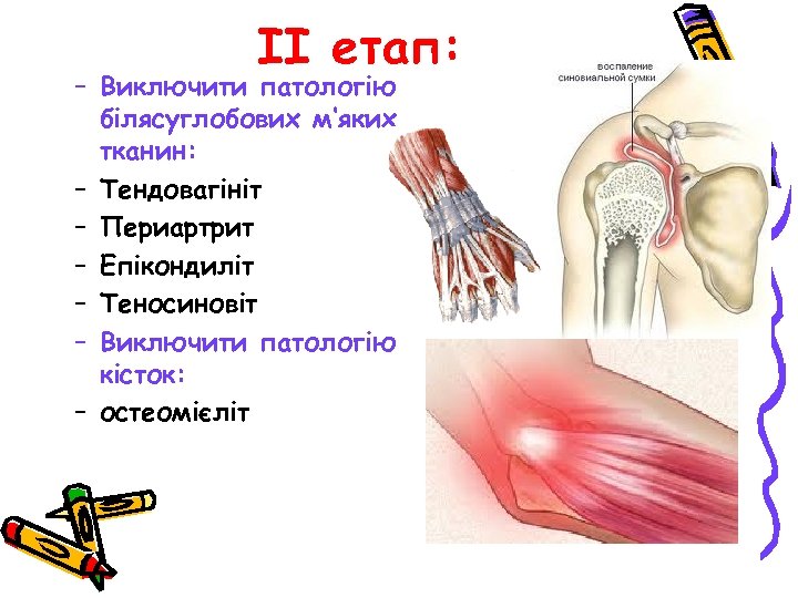 ІІ етап: – Виключити патологію білясуглобових м‘яких тканин: – Тендовагініт – Периартрит – Епікондиліт