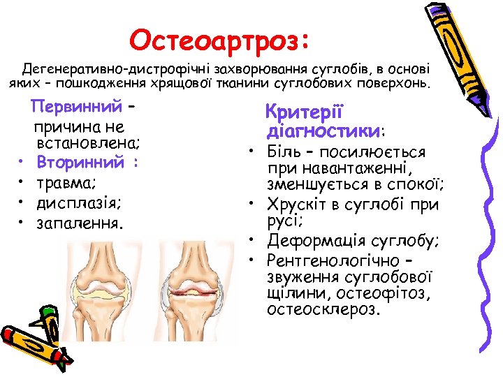 Остеоартроз: Дегенеративно-дистрофічні захворювання суглобів, в основі яких – пошкодження хрящової тканини суглобових поверхонь. •