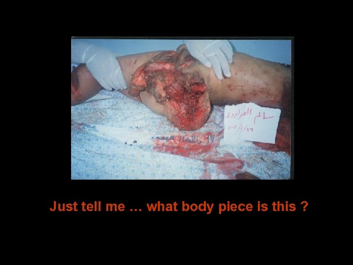 Just tell me … what body piece is this ? 