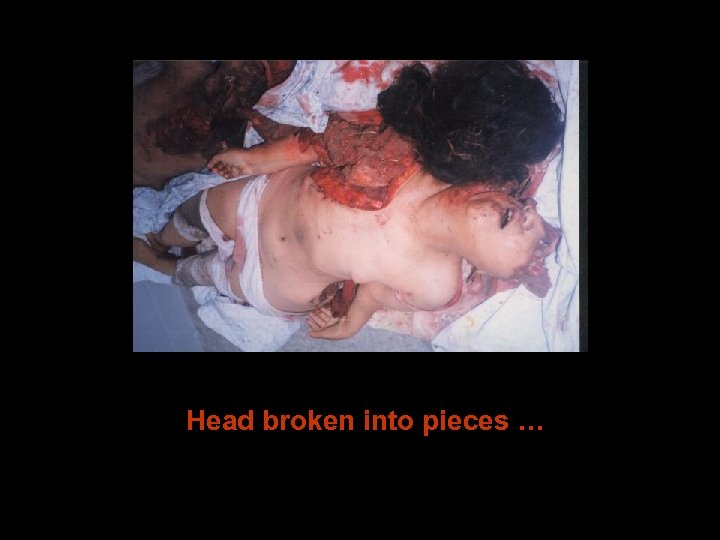 Head broken into pieces … 