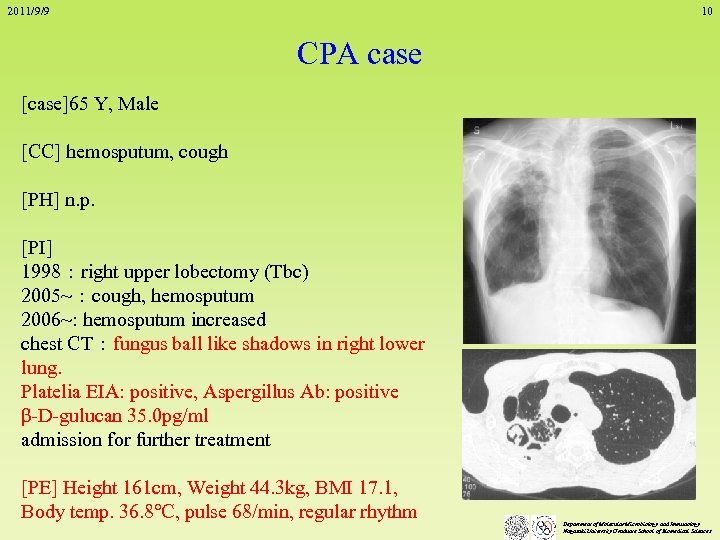 2011/9/9 10 CPA case [case]65 Y, Male [CC] hemosputum, cough [PH] n. p. [PI]