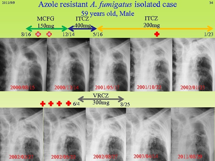 Azole resistant A. fumigatus isolated case 2011/9/9 MCFG 150 mg 8/16 2000/08/15 59 years