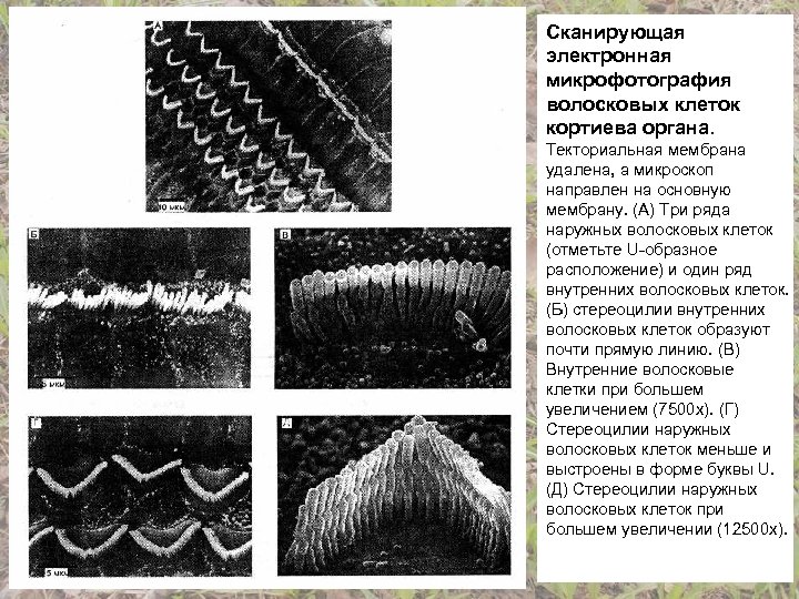 Сканирующая электронная микрофотография волосковых клеток кортиева органа. Текториальная мембрана удалена, а микроскоп направлен на