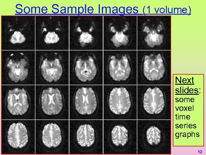 Some Sample Images (1 volume) Next slides: some voxel time series graphs 12 