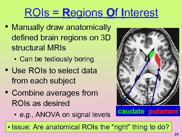ROIs = Regions Of Interest • Manually draw anatomically defined brain regions on 3