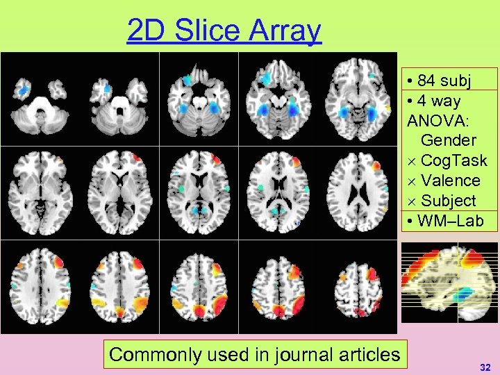 2 D Slice Array • 84 subj • 4 way ANOVA: Gender ´ Cog.