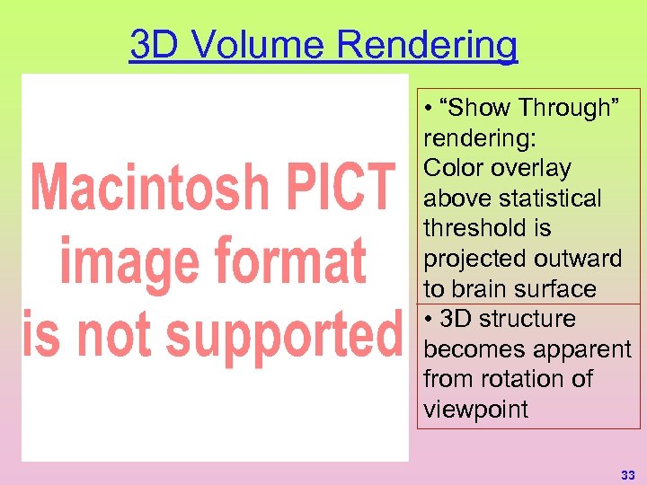 3 D Volume Rendering • “Show Through” rendering: Color overlay above statistical threshold is