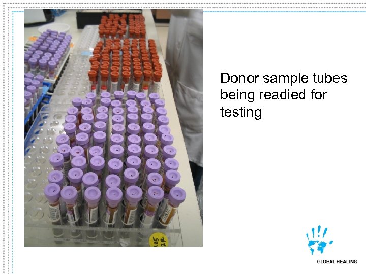 Donor sample tubes being readied for testing 