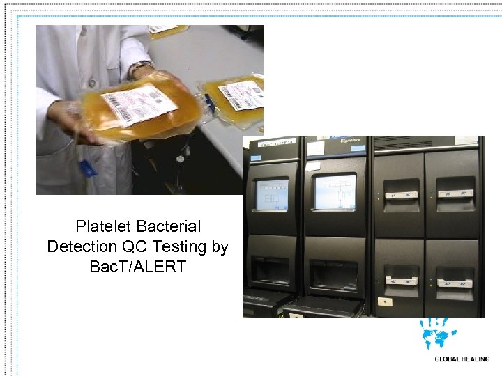 Platelet Bacterial Detection QC Testing by Bac. T/ALERT 