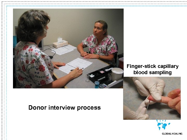 Finger-stick capillary blood sampling Donor interview process 