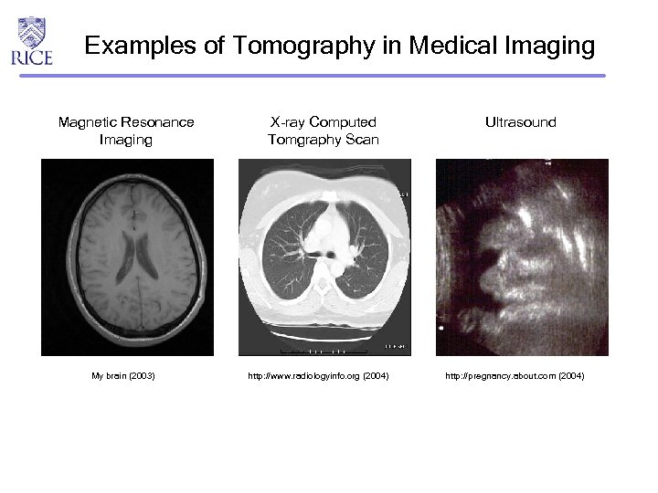 Examples of Tomography in Medical Imaging Magnetic Resonance Imaging My brain (2003) X-ray Computed