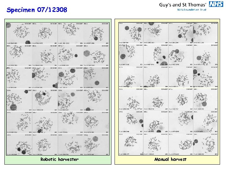 Specimen 07/12308 Robotic harvester Manual harvest 