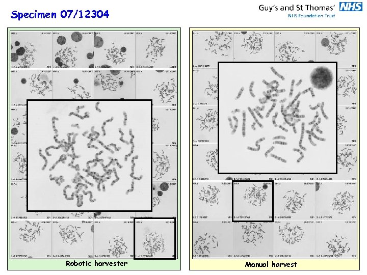 Specimen 07/12304 Robotic harvester Manual harvest 