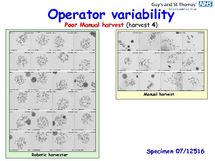 Operator variability Poor Manual harvest (harvest 4) Manual harvest Robotic harvester Specimen 07/12516 