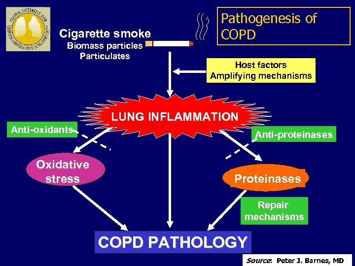 Cigarette smoke Biomass particles Particulates Pathogenesis of COPD Host factors Amplifying mechanisms LUNG INFLAMMATION