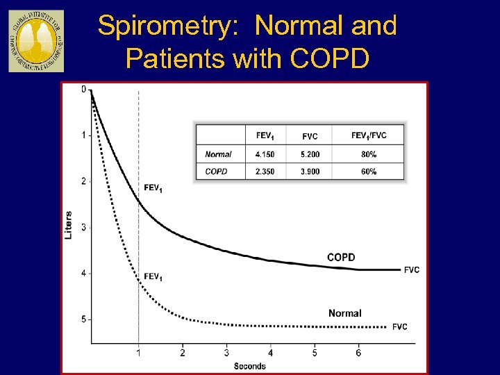Spirometry: Normal and Patients with COPD 