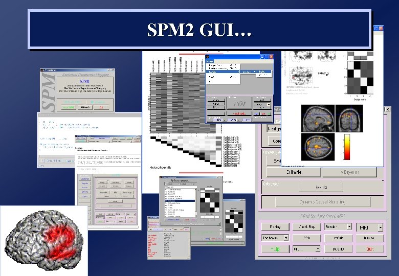 SPM 2 GUI… 