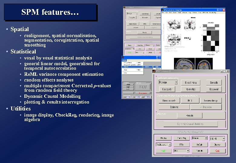 SPM features… • Spatial • realignment, spatial normalisation, segmentation, coregistration, spatial smoothing • Statistical