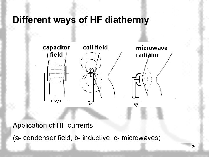 Different ways of HF diathermy Application of HF currents (a- condenser field, b- inductive,