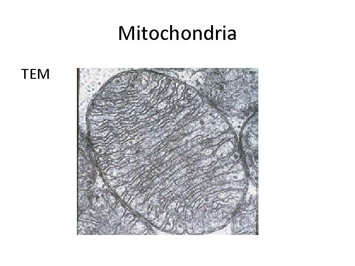 Mitochondria TEM 