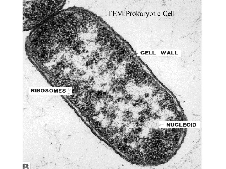 TEM Prokaryotic Cell 