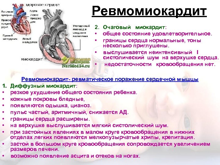 Ревмомиокардит 2. Очаговый миокардит: • общее состояние удовлетворительное. • границы сердца нормальные, тоны несколько