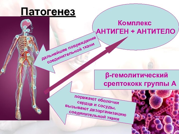 Патогенез Комплекс АНТИГЕН + АНТИТЕЛО е ени д реж кани пов й т ее