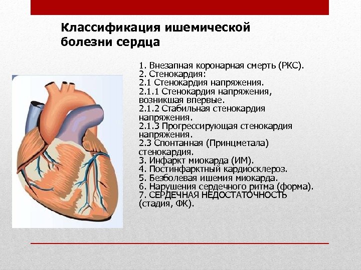 Внезапная коронарная смерть клиническая картина