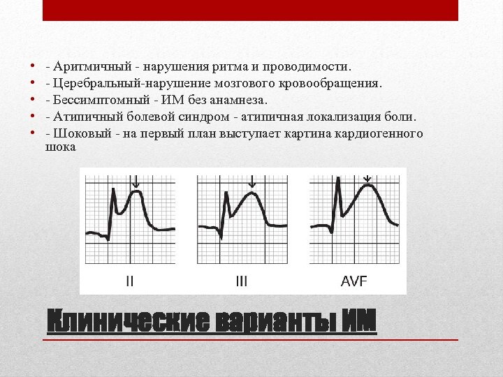  • • • - Аритмичный - нарушения ритма и проводимости. - Церебральный-нарушение мозгового